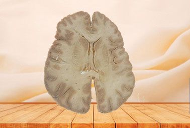 Horizontal section of brain through inner capsule plastinated specimen