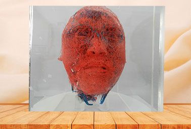 Blood vessels of head and neck casting specimen