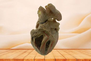 Cardiac conduction system plastinated speciemen