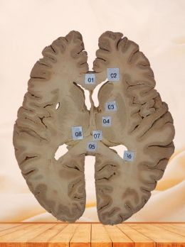 Horizontal section of brain plastinated specimen