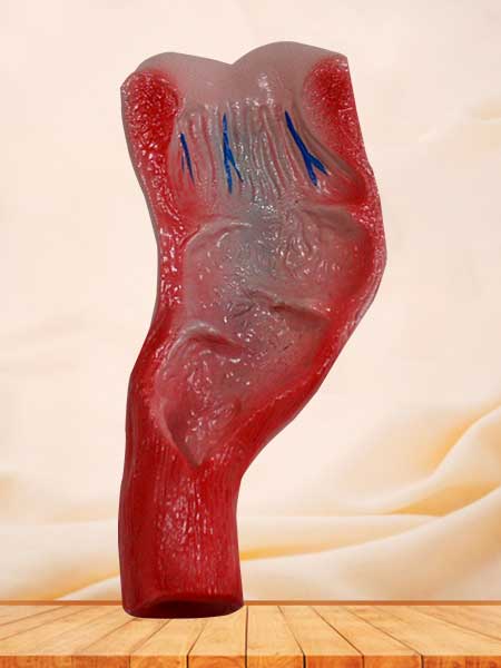 human rectum cavity model