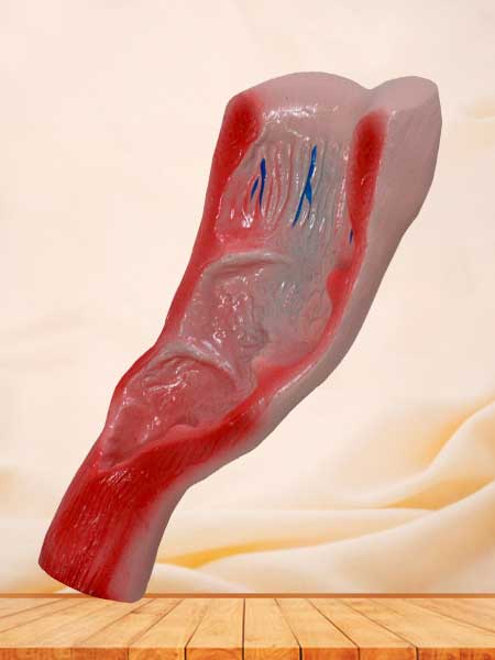 rectum cavity anatomy model