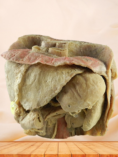 Abdominal viscera and caeliac trunk medical specimen