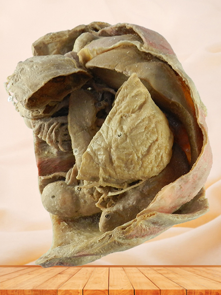 Abdominal viscera and caeliac trunk specimen