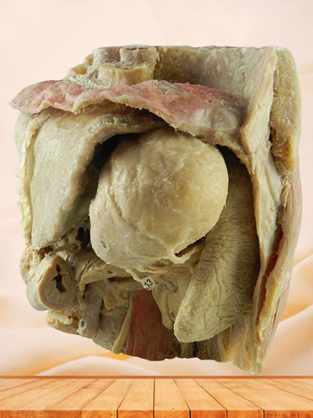 Abdominal viscera and caeliac trunk teaching specimen