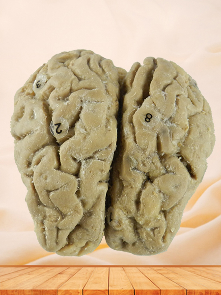 Brain of Horse specimen
