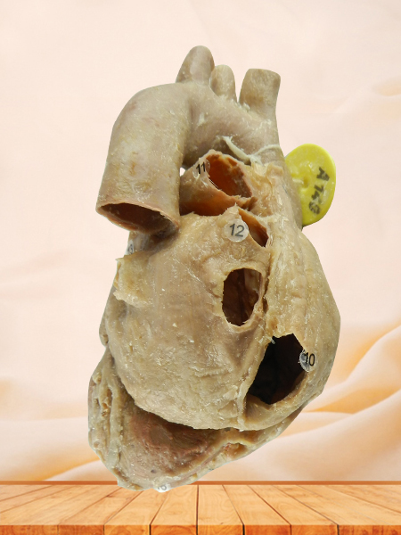 Heart with coronary vessels plastination