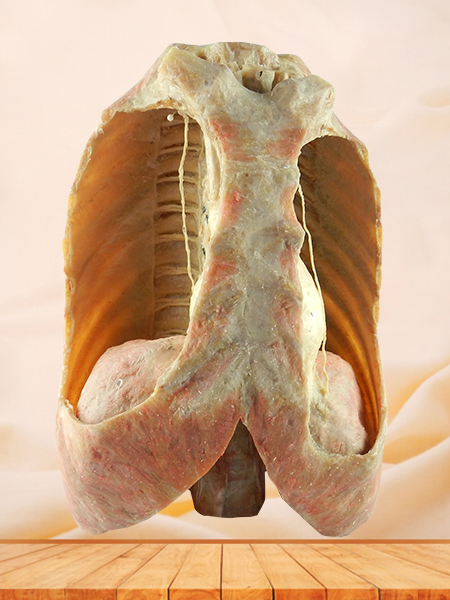 Mediastinal viscera with thorax plastination