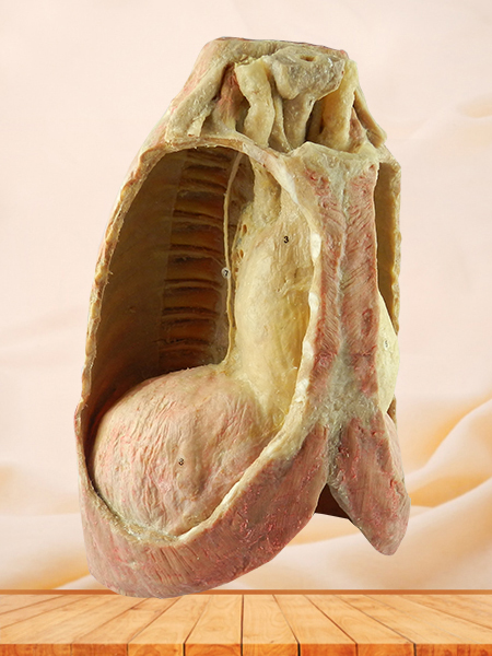 Mediastinal viscera with thorax specimen