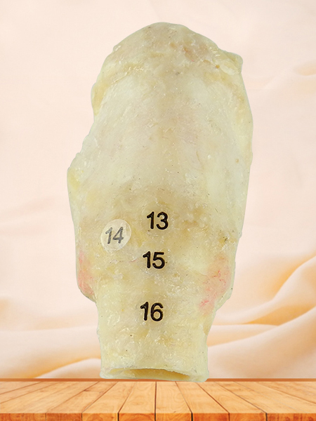 laryngeal muscle plastinated human specimen