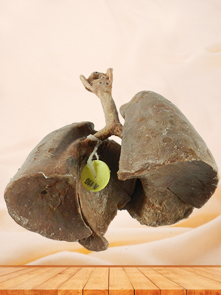 lung and larynx teaching specimen