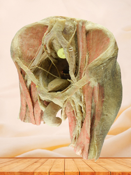 male pelvic viscera plastination