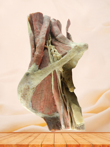 sagittal section of female pelvis with uterus vessels specimen