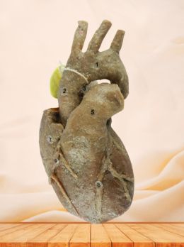 Heart with coronary vessels plastination specimen