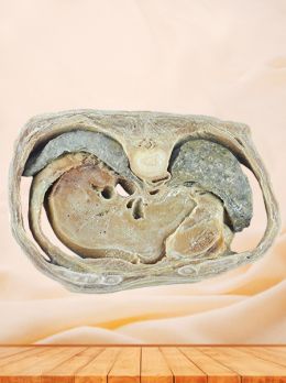 Horizontal slices of complete male body plastinated specimen
