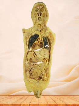 Coronal section of human body plastinated specimen