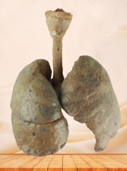 Child lung and larynx plastinated specimen