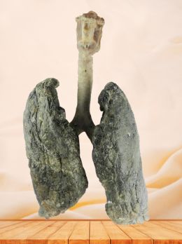 Adult lung and larynx plastinated specimen