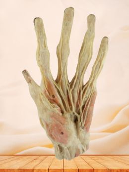 Superficial arteries of hand plastinated specimen