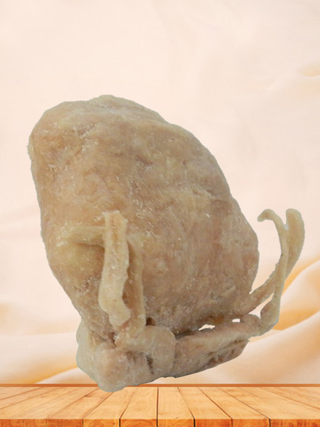 Prostate seminal vescle bladder human specimen