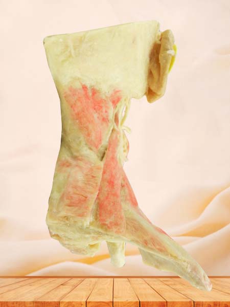 External carotid artery and its branches plastination