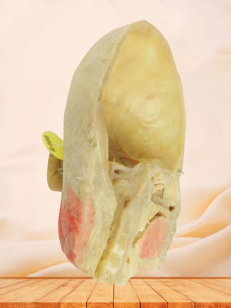 Paranasal sinuses and its opening specimen