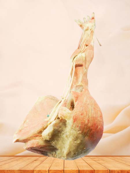 Deep arteries  of upper limb specimen