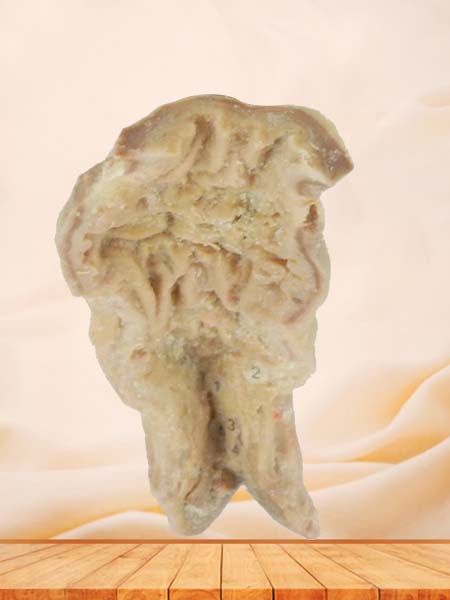 Rectum and anal canal teaching specimen