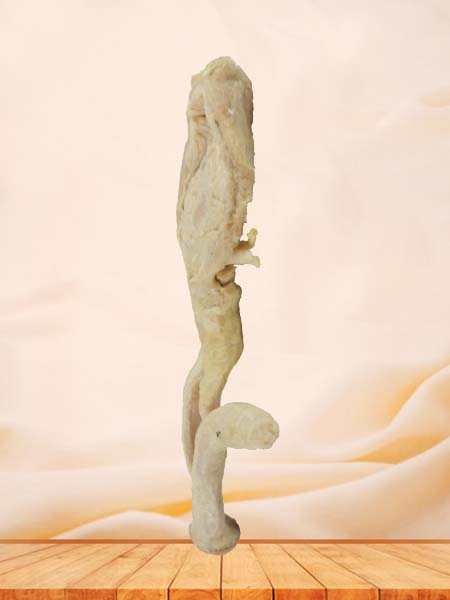 corpus cavernosum penis plastinated cadaver