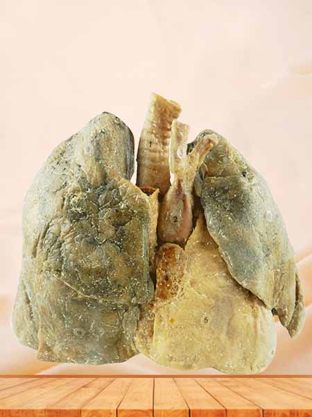 Heart and 2 lungs medical specimen