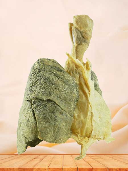 Heart and 2 lungs specimen