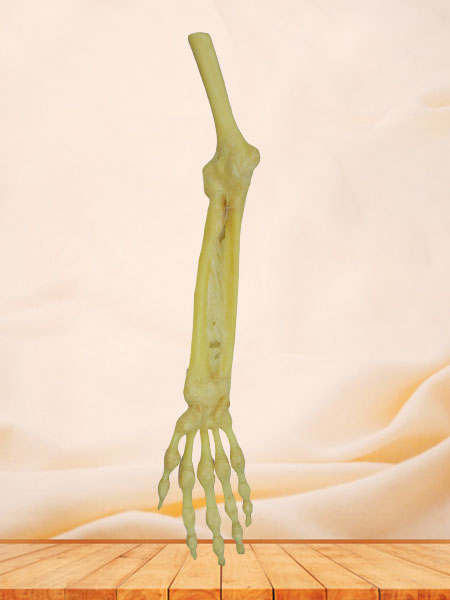 Joint of the upper limb without shoulder