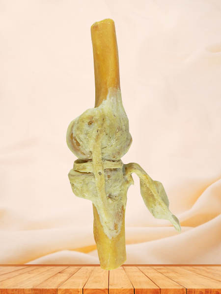 saggital section of knee joint specimen