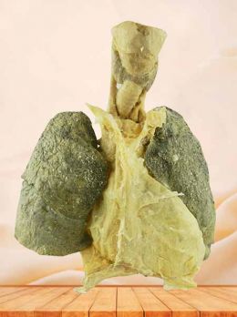 Heart and 2 lungs plastinated specimen