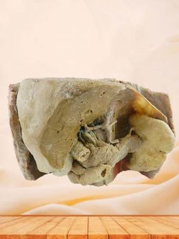 Liver spleen pancreas  and duodenum plastinated anatomy specimen