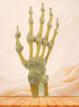 Hand joint plastinated specimen