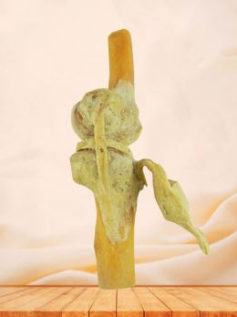 Sagittal section of knee joint specimen