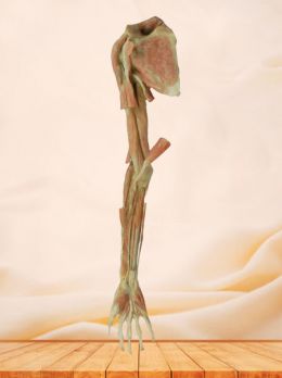 Superficial and deep muscle of upper limb plastinated specimen