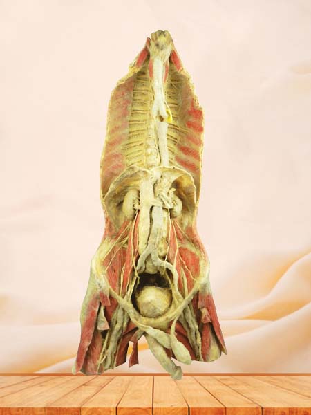 Posterior Wall Structure of Chest and Abdomen Plastination