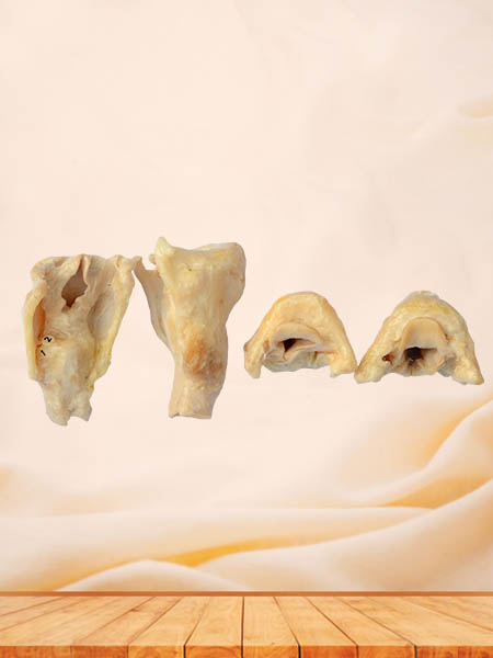 Laryngeal cartilages plastinated specimen