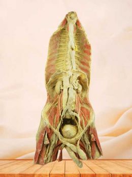 Azygos system plastinated specimen