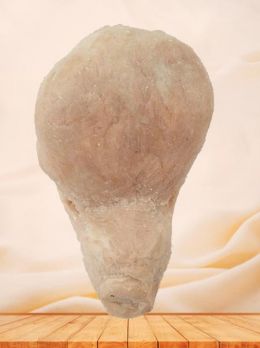 Human urinary bladder plastinated specimen