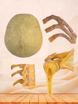 Classification of bone union specimen