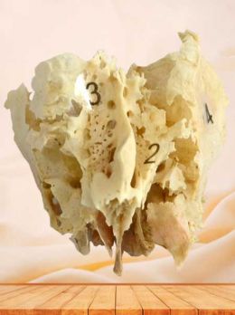 Human ethmoid bone specimen