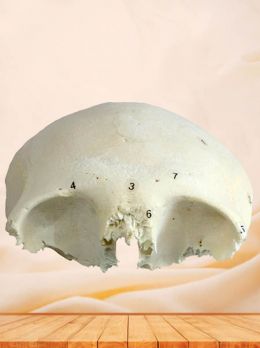 Human frontal bone specimen
