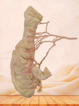 Human ileocecal vessel plastinated specimen