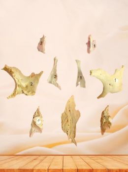 Nasal bone, lacrimal bone, zygomatic bone, inferior nasal concha and vomer specimen