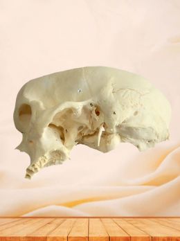Human pterygopalatine fossa specimen