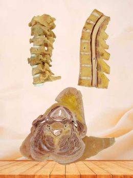 Human uncovertebral joint plastinated specimen