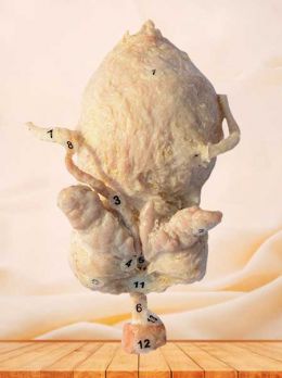 Urinary bladder, prostate, seminal vesicle and urethral gland plastinated specimen